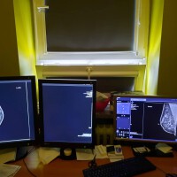 monitory stosowane do prezentacji obrazów medycznych